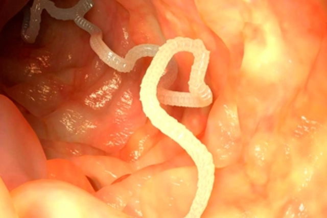 Imagen ilustrativa del artículo 10 síntomas de parásitos intestinales